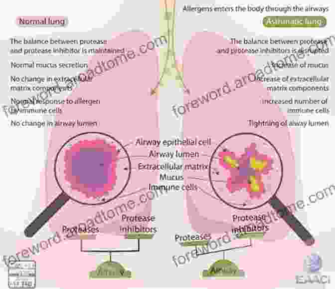 Airway Wall Remodelling In Asthma Airway Wall Remodelling In Asthma (Handbooks In Pharmacology And Toxicology 40)