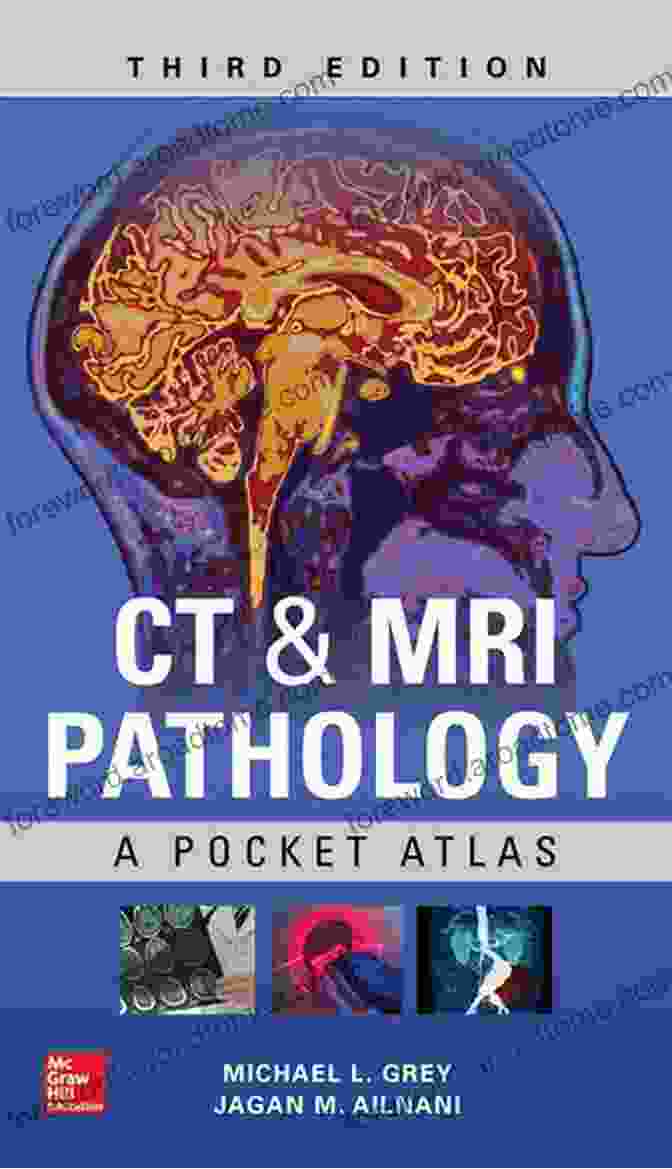 CT MRI Pathology Pocket Atlas Third Edition CT MRI Pathology: A Pocket Atlas Third Edition