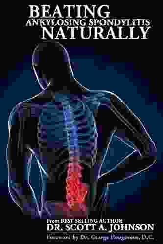 Beating Ankylosing Spondylitis Naturally Dr Scott A Johnson