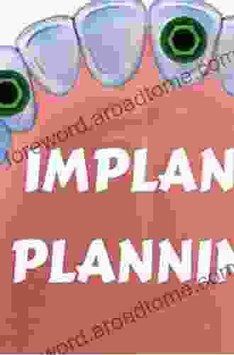 Implant Treatment Planning for the Edentulous Patient: A Graftless Approach to Immediate Loading