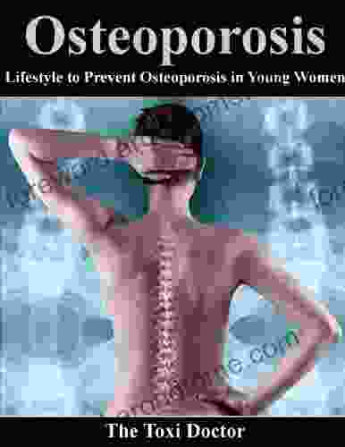 Osteoporosis Lifestyle to Prevent Osteoporosis in Young Women