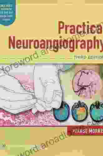 Practical Guide To Neurovascular Emergencies