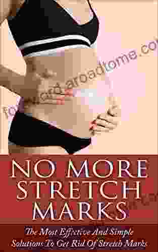 No More Stretch Marks: The Most Effective And Simple Solutions To Get Rid Of Stretch Marks (get Rid Of Stretch Marks Pregnancy Stretch Marks Remove Stretch Marks)