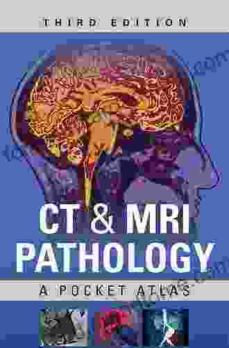 CT MRI Pathology: A Pocket Atlas Third Edition