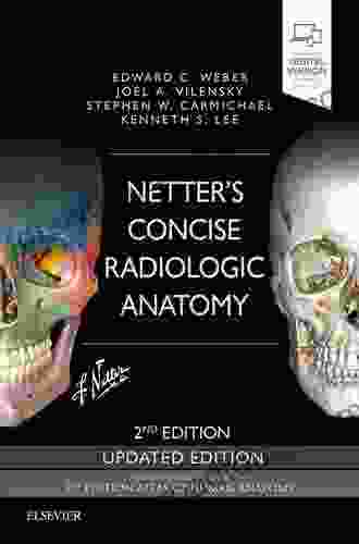 Netter s Concise Radiologic Anatomy Updated Edition (Netter Basic Science)