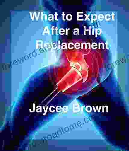 What To Expect After A Hip Replacement